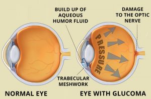 Cornea Image