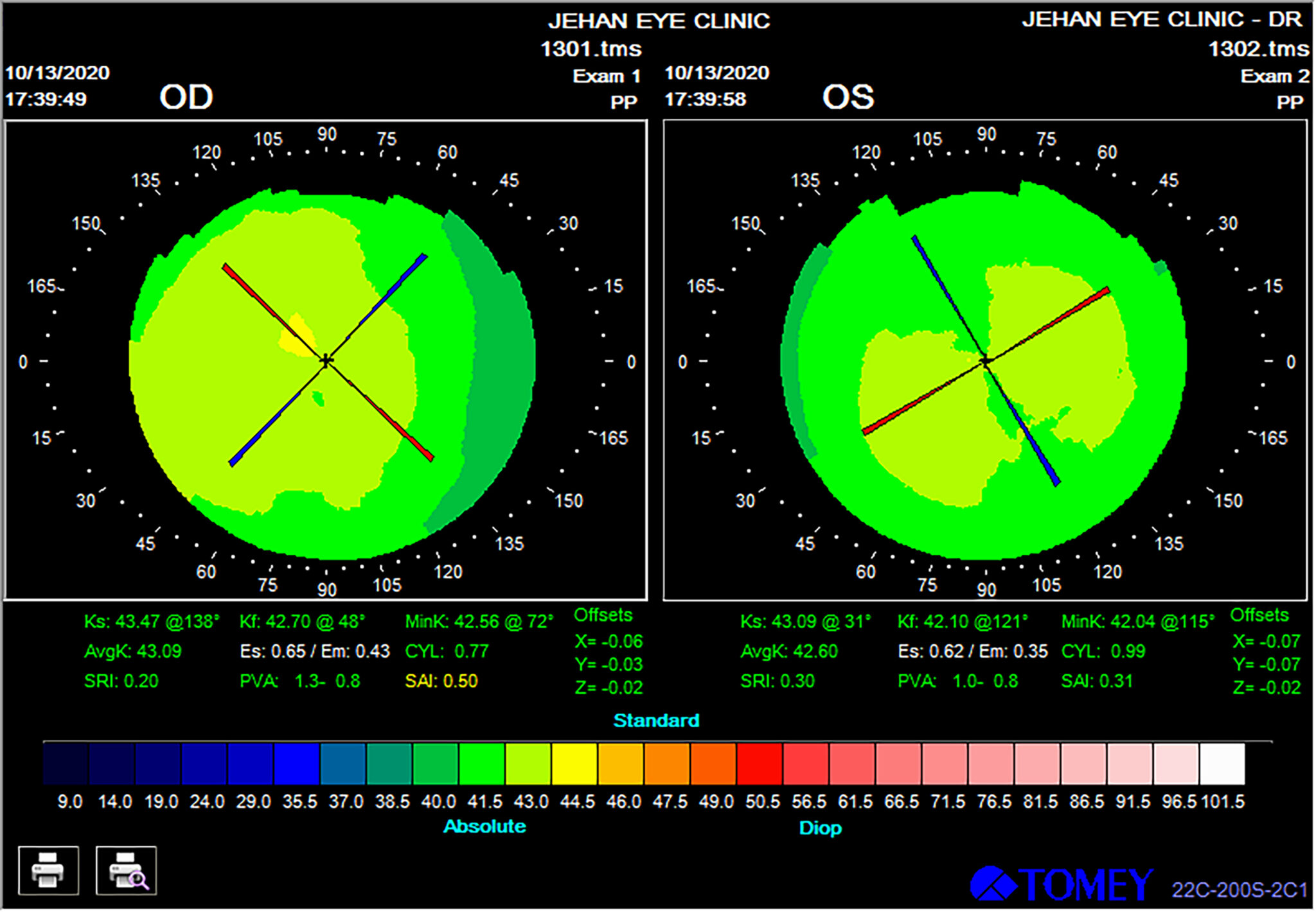 Corneal Topography - Jehan Eye Clinic