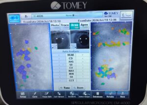 Specular Microscopy